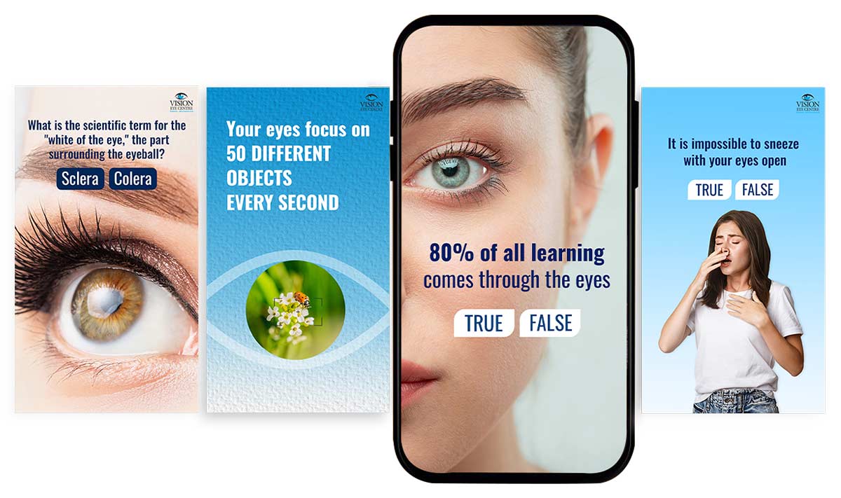 Sneek peep of Visioneye center Social Media Case Study